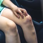 Bekas Luka: Penyebab, Jenis, dan Cara Merawatnya agar Lebih Samar